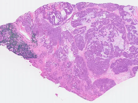 Human ovary preview