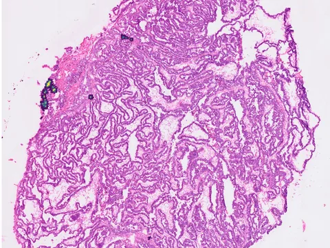 Human ovary preview
