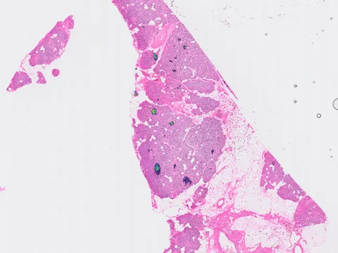 Human pancreas preview