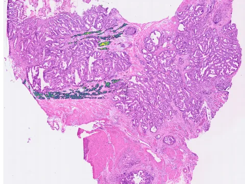 Human pancreas preview