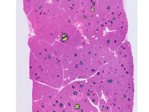 Human pancreas preview