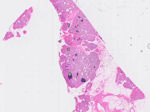Human pancreas preview