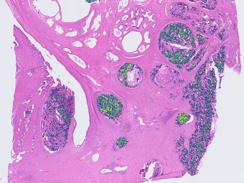 Human prostate gland preview