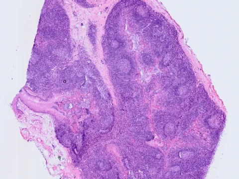 Human tonsil preview