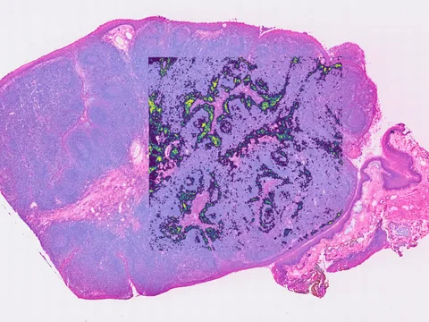 Human tonsil preview