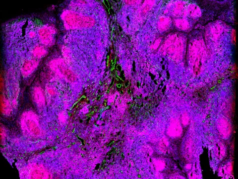 Human tonsil preview