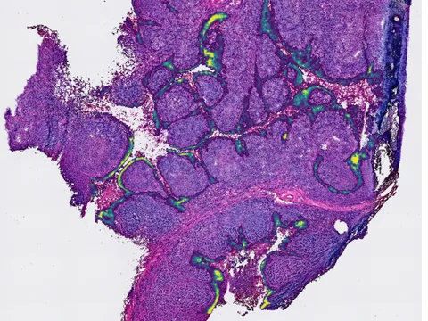 Human tonsil preview