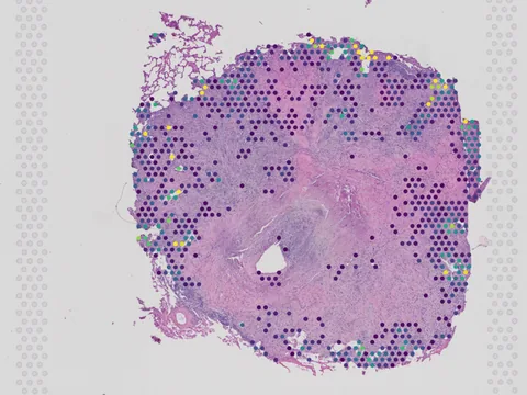 Human bone element preview
