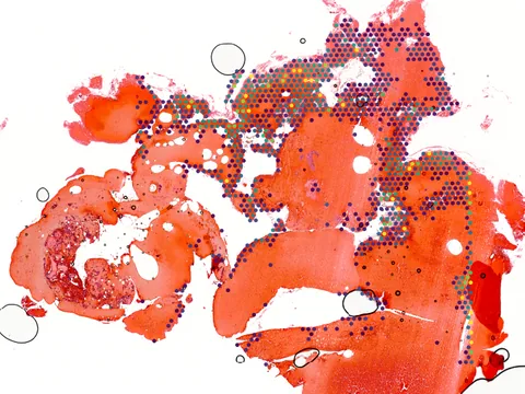 Human bone tissue preview
