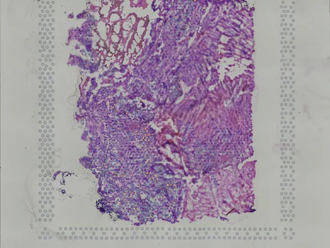 Human brain preview