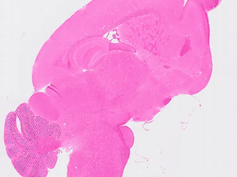 Mouse brain preview