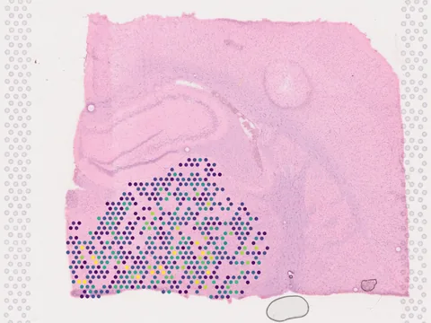 Rat brain preview