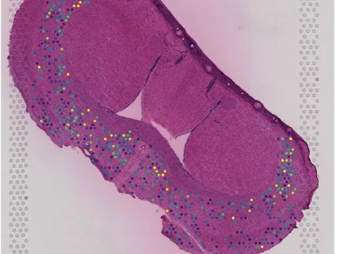 Mouse brain preview