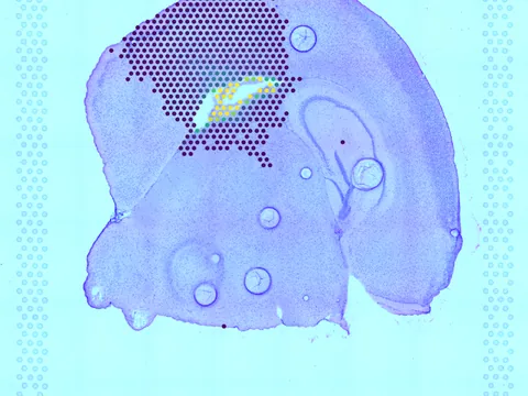 Mouse brain preview
