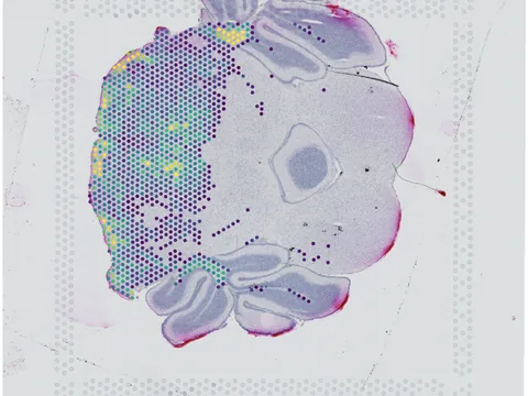 Mouse brain preview