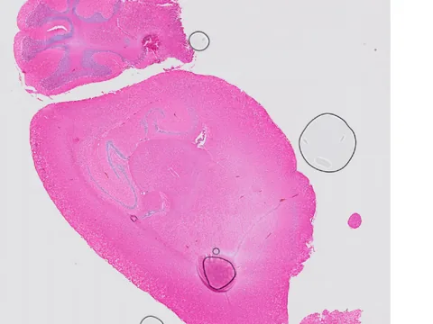 Mouse brain preview