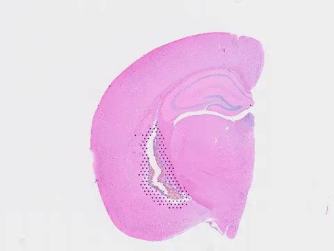 Mouse brain preview
