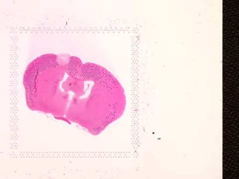Mouse brain preview