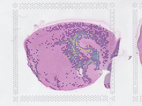 Mouse brain preview