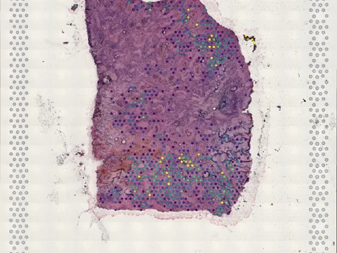 Human brain preview