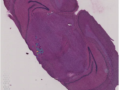 Mouse brain preview