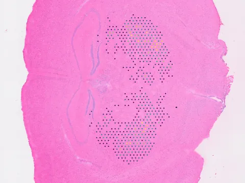 Mouse brain preview