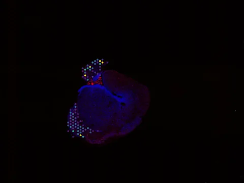 Mouse brain preview