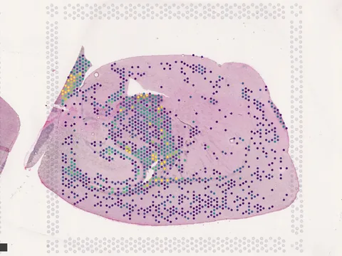 Mouse brain preview