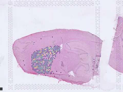 Mouse brain preview