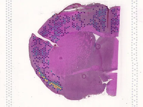 Mouse brain preview