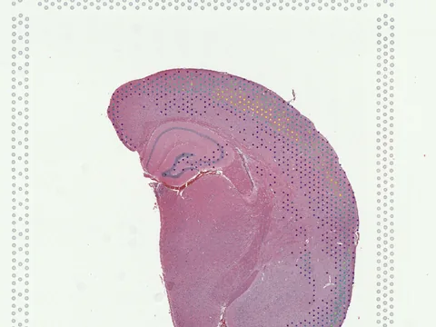 Mouse brain preview