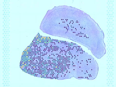 Mouse brain preview