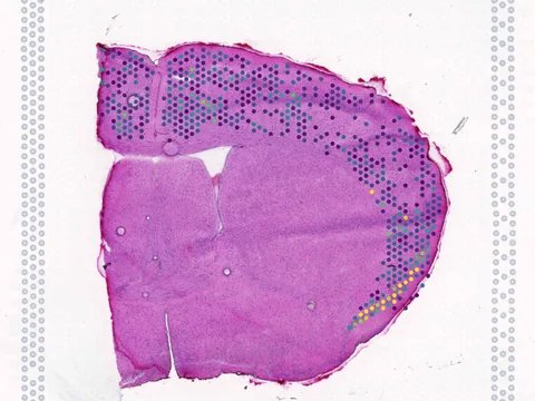 Mouse brain preview