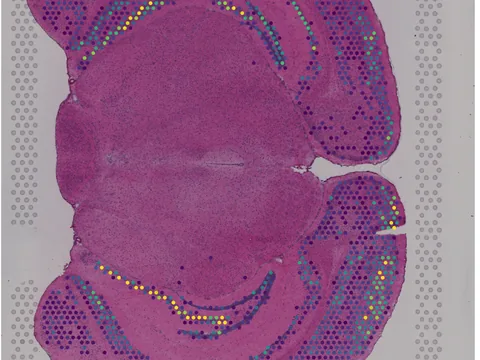 Mouse brain preview