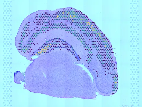 Mouse brain preview