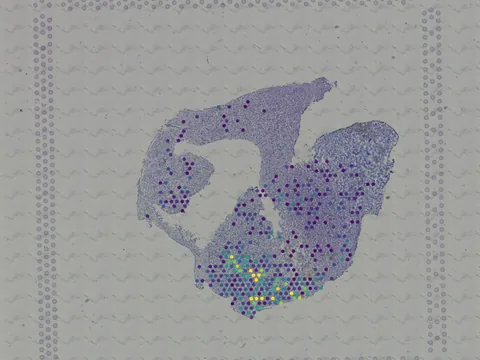 Human brain preview