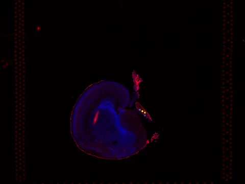 Mouse brain preview