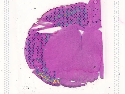 Mouse brain preview