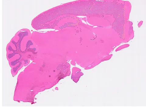 Mouse brain preview