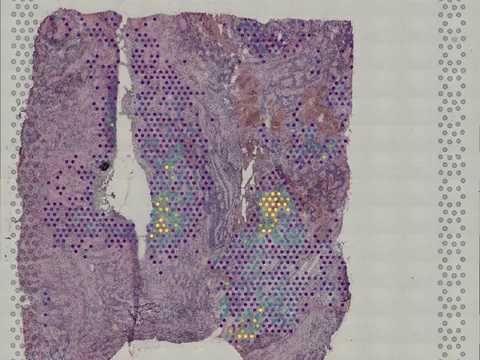 Human brain preview