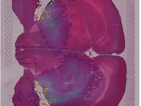 Mouse brain preview