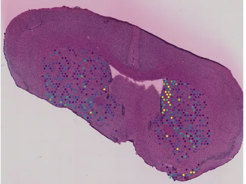 Mouse brain preview