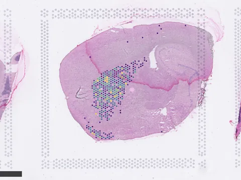 Mouse brain preview