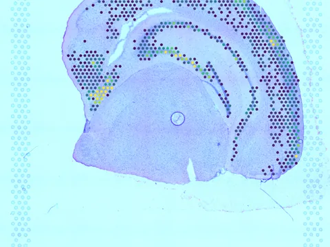 Mouse brain preview