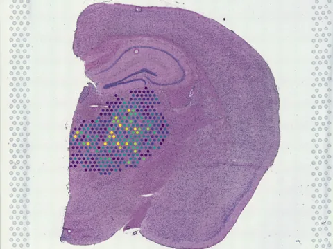 Mouse brain preview