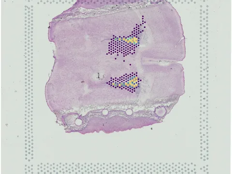 Mouse brain preview