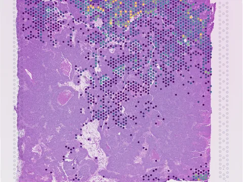 Human brain preview