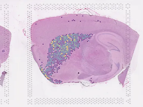 Mouse brain preview