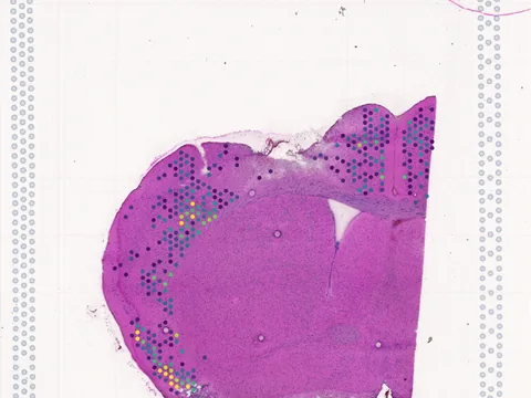 Mouse brain preview