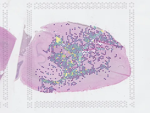 Mouse brain preview